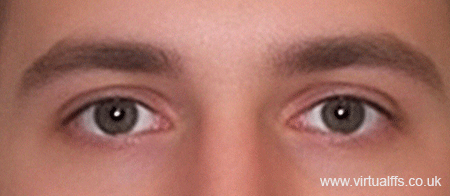 virtual ffs eyes